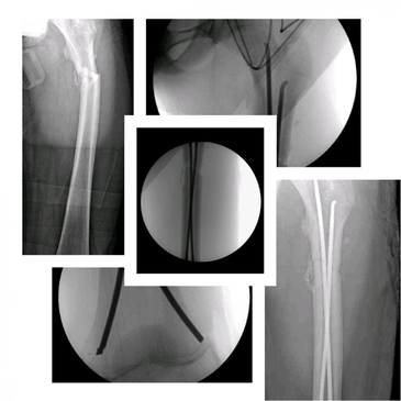 Slider image (4) Dr. Rodrigo Aguirre Rojas Orthopedic Surgeon